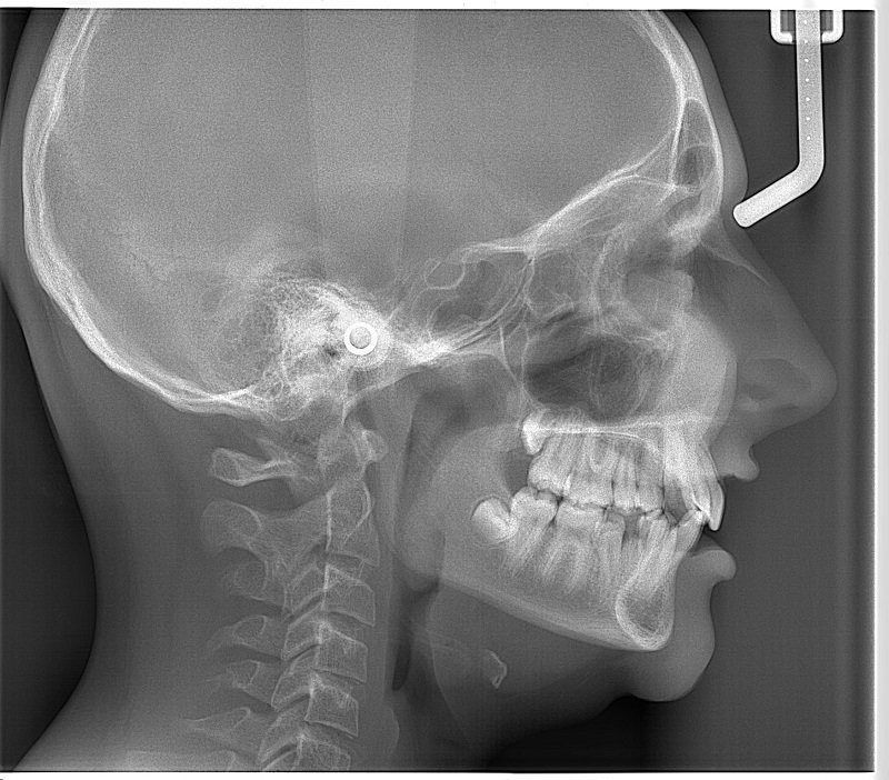 Spektra Dent - radiologie dentara