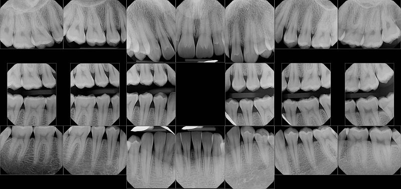 Spektra Dent - radiologie dentara