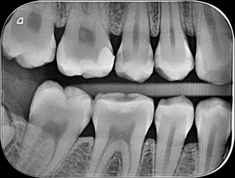 Spektra Dent - radiologie dentara