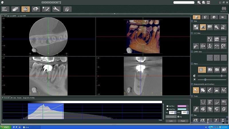 Spektra Dent - radiologie dentara