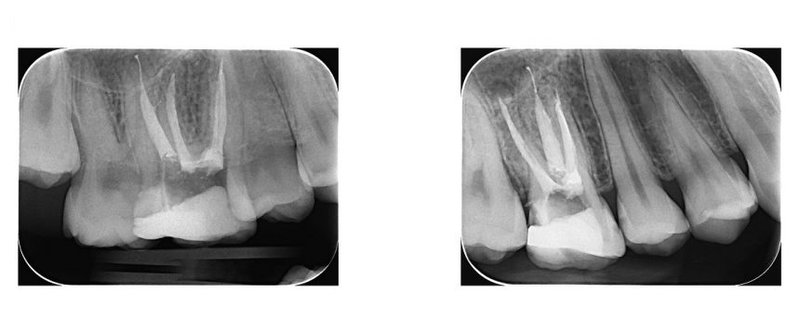 Spektra Dent - radiologie dentara