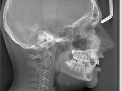 Spektra Dent - radiologie dentara